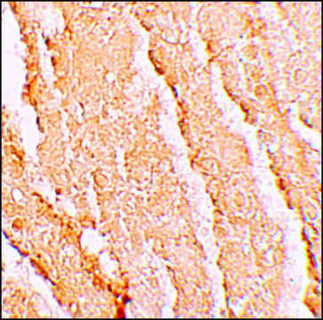 抗 VPS39 兔抗 affinity isolated antibody