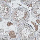 Anti-CERS3 antibody produced in rabbit Prestige Antibodies® Powered by Atlas Antibodies, affinity isolated antibody, buffered aqueous glycerol solution