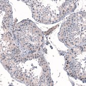 Anti-MGA antibody produced in rabbit Prestige Antibodies® Powered by Atlas Antibodies, affinity isolated antibody, buffered aqueous glycerol solution