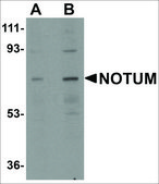 Anti-NOTUM antibody produced in rabbit affinity isolated antibody, buffered aqueous solution