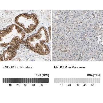 Anti-ENDOD1 antibody produced in rabbit Prestige Antibodies&#174; Powered by Atlas Antibodies, affinity isolated antibody, buffered aqueous glycerol solution