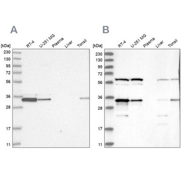 Anti-PRKRA antibody produced in rabbit Prestige Antibodies&#174; Powered by Atlas Antibodies, affinity isolated antibody