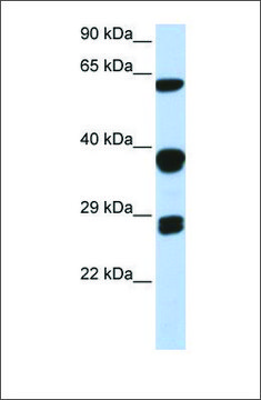 Anti-SNRPB antibody produced in rabbit affinity isolated antibody