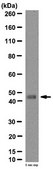 Anti-IL-13 receptor Antibody, alpha-2 (IL-13RA2) from rabbit, purified by affinity chromatography