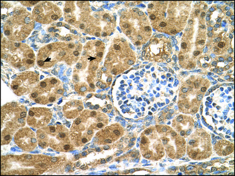 Anti-PTGDS antibody produced in rabbit affinity isolated antibody