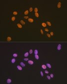 Anti-ZBTB7A/FBI-1/LRF antibody produced in rabbit