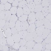 Anti-VAT1L antibody produced in rabbit Prestige Antibodies® Powered by Atlas Antibodies, affinity isolated antibody, buffered aqueous glycerol solution