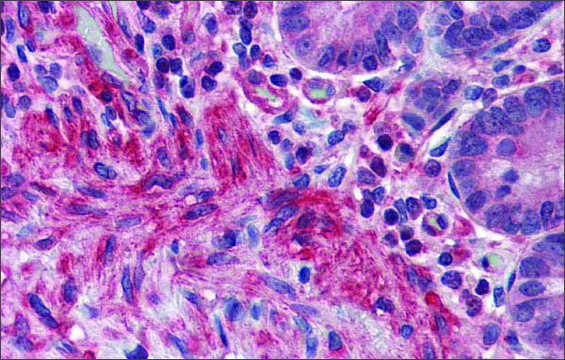 Anti-PRDM5 (ab2) antibody produced in rabbit affinity isolated antibody