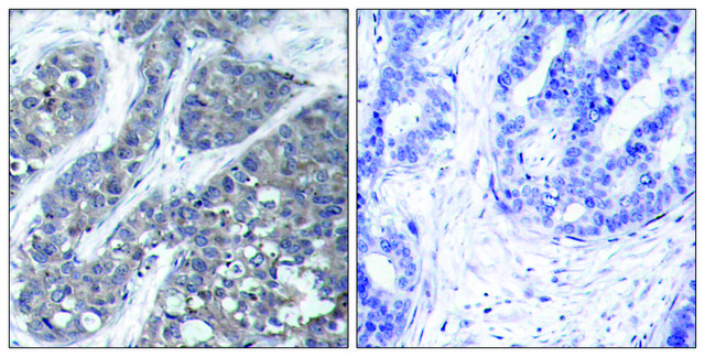 Anti-PYK2 antibody produced in rabbit affinity isolated antibody