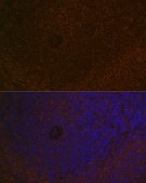 Anti-CARD11 antibody produced in rabbit