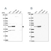 Anti-RRS1 antibody produced in rabbit Prestige Antibodies® Powered by Atlas Antibodies, affinity isolated antibody, buffered aqueous glycerol solution