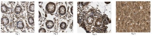 Anti-Connexin-26 Antibody, clone 3B12.1 clone 3B12.1, from mouse