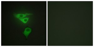Anti-PDLIM1 antibody produced in rabbit affinity isolated antibody