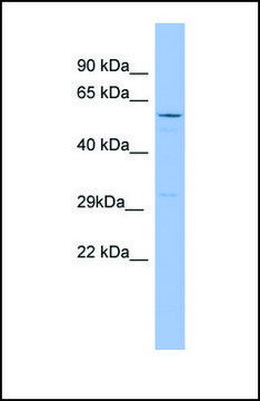 Anti-RRAD antibody produced in rabbit affinity isolated antibody