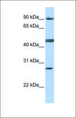 Anti-CENPI antibody produced in rabbit affinity isolated antibody