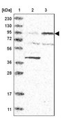 Anti-ITGB8 antibody produced in rabbit Prestige Antibodies® Powered by Atlas Antibodies, affinity isolated antibody, buffered aqueous glycerol solution, ab1