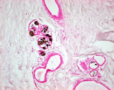 银染试剂盒，依据von Kossa for the detection of microcalcification