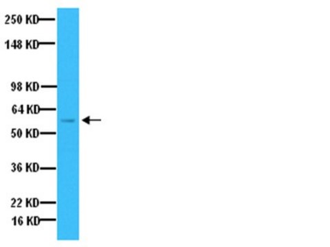 Anti-Tyrosine Hydroxylase Antibody Chemicon&#174;, from sheep