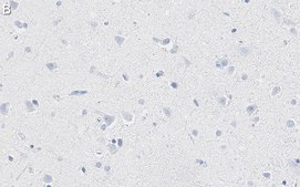 Anti-K+/Cl- Cotransporter-2 Antibody, clone 5E13 ZooMAb® Rabbit Monoclonal recombinant, expressed in HEK 293 cells