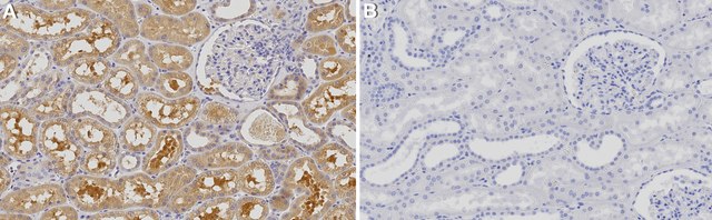 Anti-GCLC Antibody, clone 2H13 ZooMAb&#174; Rabbit Monoclonal recombinant, expressed in HEK 293 cells