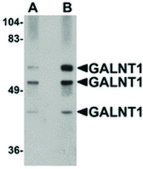 Anti-GALNT10 antibody produced in rabbit affinity isolated antibody