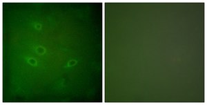 Anti-CARD6 antibody produced in rabbit affinity isolated antibody