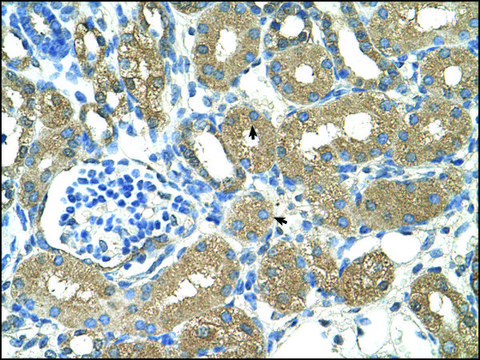 Anti-ADH4 antibody produced in rabbit IgG fraction of antiserum