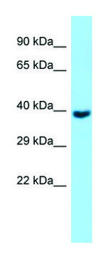 Anti-GNA11 (C-terminal) antibody produced in rabbit affinity isolated antibody