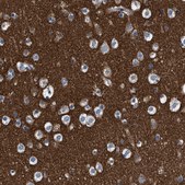 Anti-ATP6V0A1 antibody produced in rabbit Prestige Antibodies® Powered by Atlas Antibodies, affinity isolated antibody, buffered aqueous glycerol solution