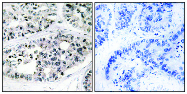 Anti-Collagen VII &#945;1 antibody produced in rabbit affinity isolated antibody