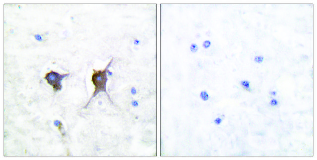 Anti-BAX antibody produced in rabbit affinity isolated antibody