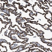 Anti-SLC22A15 antibody produced in rabbit Prestige Antibodies® Powered by Atlas Antibodies, affinity isolated antibody, buffered aqueous glycerol solution