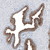 Anti-TMPRSS2 antibody produced in mouse Prestige Antibodies® Powered by Atlas Antibodies, clone CL12511, purified by using Protein A, buffered aqueous glycerol solution