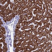 Anti-ANKRD29 antibody produced in rabbit Prestige Antibodies® Powered by Atlas Antibodies, affinity isolated antibody, buffered aqueous glycerol solution