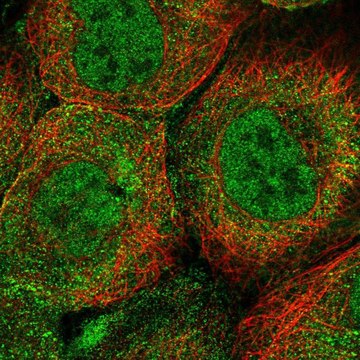 Anti-UBE2A antibody produced in rabbit Prestige Antibodies&#174; Powered by Atlas Antibodies, affinity isolated antibody