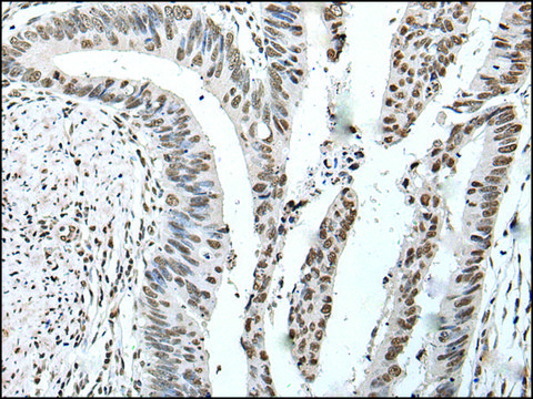 Anti-POT1 affinity isolated antibody