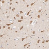 Anti-HS3ST1 antibody produced in rabbit Prestige Antibodies® Powered by Atlas Antibodies, affinity isolated antibody, buffered aqueous glycerol solution