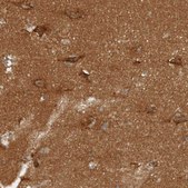 Anti-NAPG antibody produced in rabbit Prestige Antibodies® Powered by Atlas Antibodies, affinity isolated antibody, buffered aqueous glycerol solution