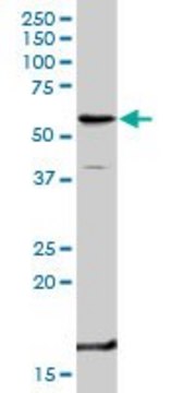 Anti-TNFRSF1B antibody produced in rabbit purified immunoglobulin, buffered aqueous solution