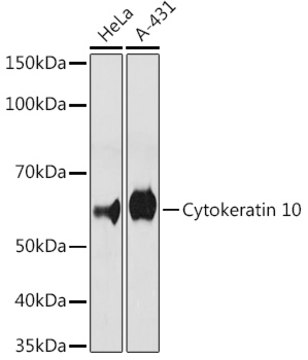 Anti-Cytokeratin 10 Antibody, clone 4S5Y7, Rabbit Monoclonal