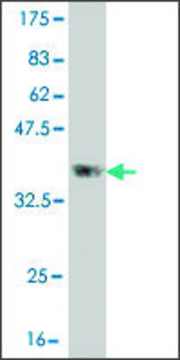 Monoclonal Anti-CLCA2 antibody produced in mouse clone 1B9, purified immunoglobulin, buffered aqueous solution