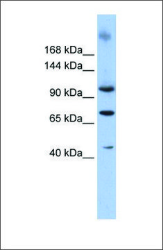 Anti-TUT1 antibody produced in rabbit affinity isolated antibody