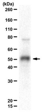 Anti-Histone-lysine N-methyltransferase SUV39H2 Antibody from rabbit, purified by affinity chromatography