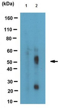 抗磷酸化Tau（Thr181），克隆1E7 抗体 clone 1E7, from mouse, purified by affinity chromatography