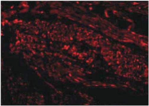 Anti-TIM-1 Antibody from rabbit, purified by affinity chromatography