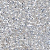 抗-FHL2 兔抗 Ab1, Prestige Antibodies® Powered by Atlas Antibodies, affinity isolated antibody, buffered aqueous glycerol solution