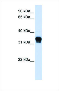 Anti-CSNK1A1 antibody produced in rabbit affinity isolated antibody