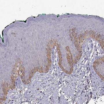 Anti-TACR1 antibody produced in rabbit Prestige Antibodies&#174; Powered by Atlas Antibodies, affinity isolated antibody