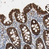 Anti-TST antibody produced in rabbit Prestige Antibodies® Powered by Atlas Antibodies, affinity isolated antibody, buffered aqueous glycerol solution