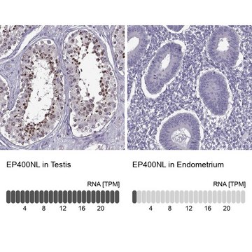 Anti-EP400NL antibody produced in rabbit Prestige Antibodies&#174; Powered by Atlas Antibodies, affinity isolated antibody, buffered aqueous glycerol solution